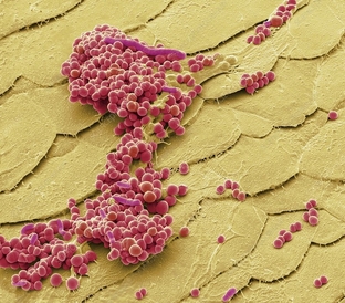 頭皮屑上的細菌